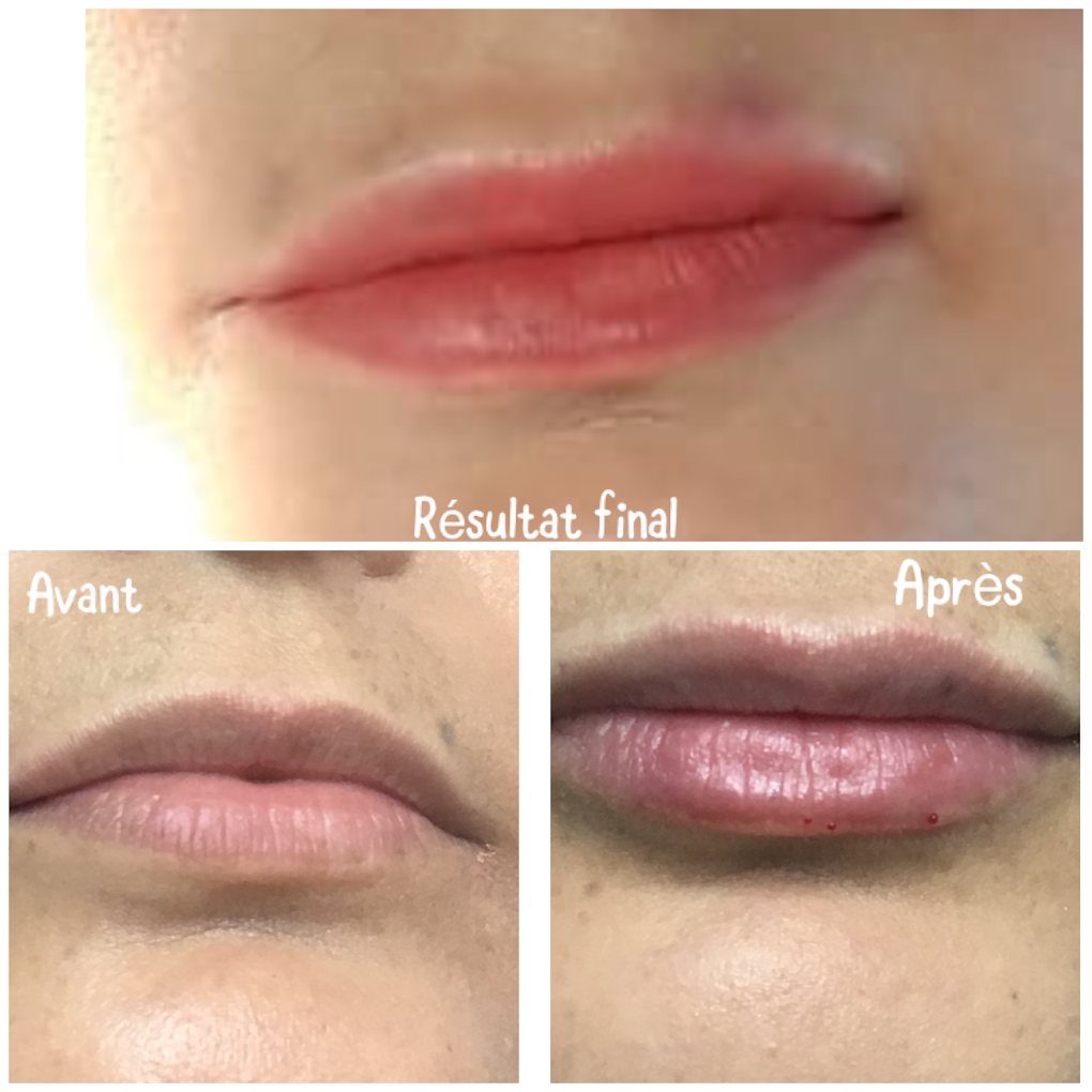 Résultat 1